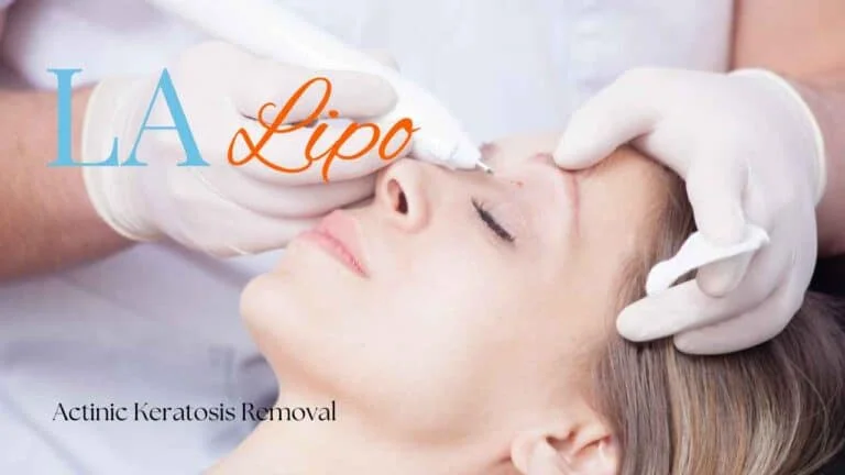 Woman receiving Actinic Keratosis Removal Treatment Hockley