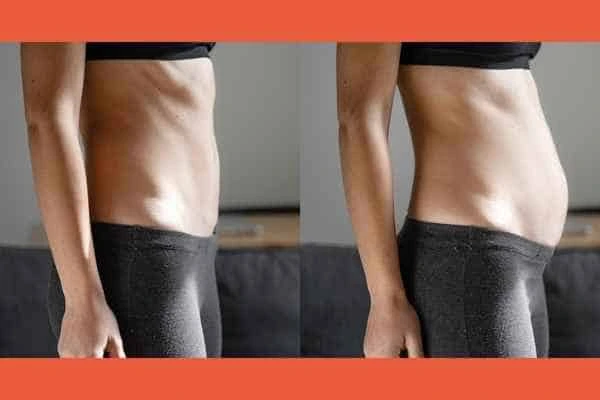 LA-EMS Body Sculpting results Hockley