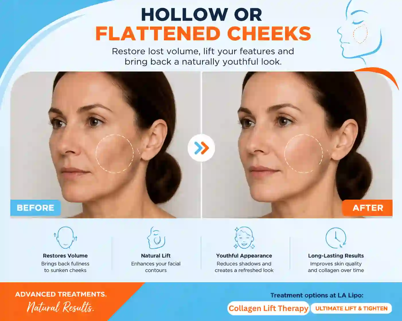 Sign #4: Hollow or Flattened Cheeks Hockley