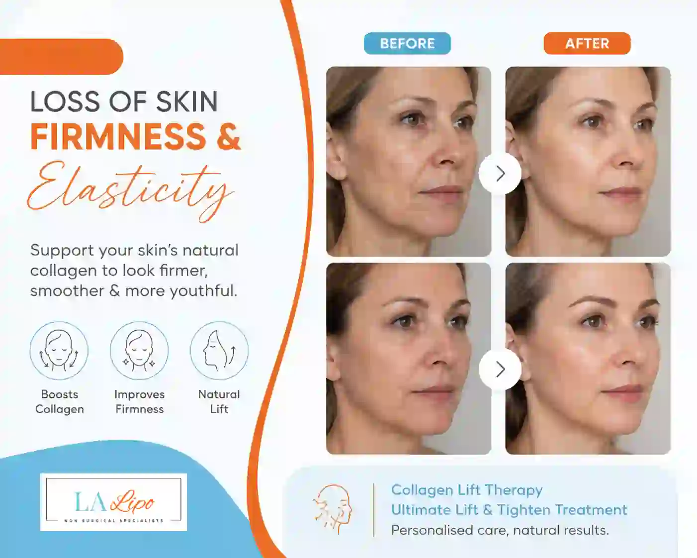 Sign #7: Loss of Skin Firmness and Elasticity Hockley