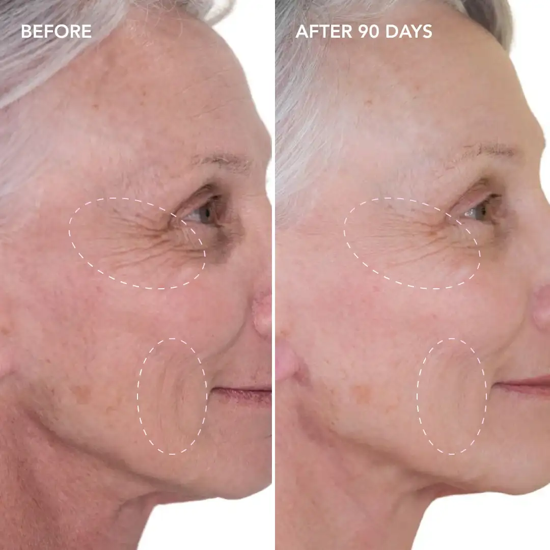 When will you see results Hockley